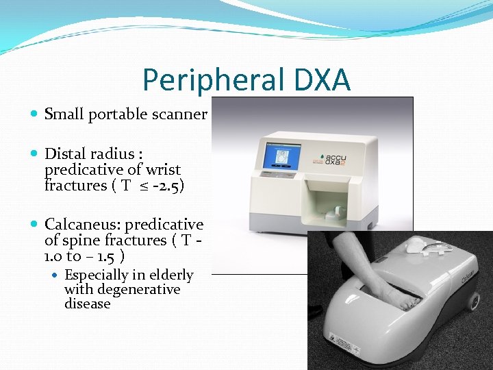 Peripheral DXA Small portable scanner Distal radius : predicative of wrist fractures ( T