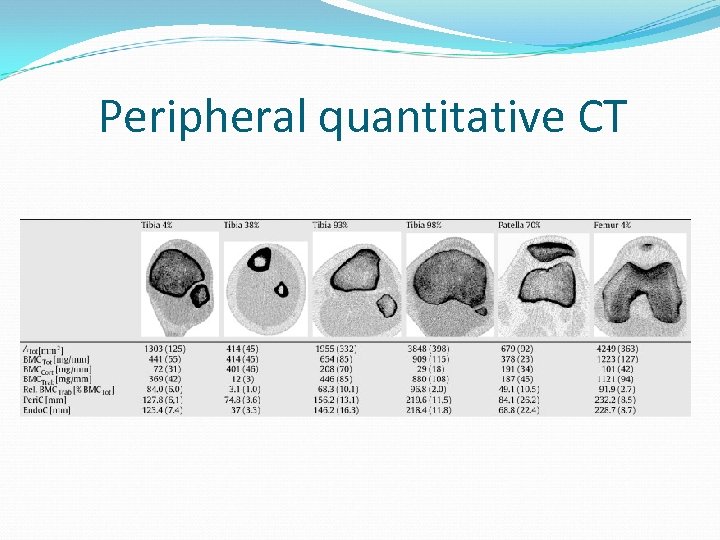 Peripheral quantitative CT 