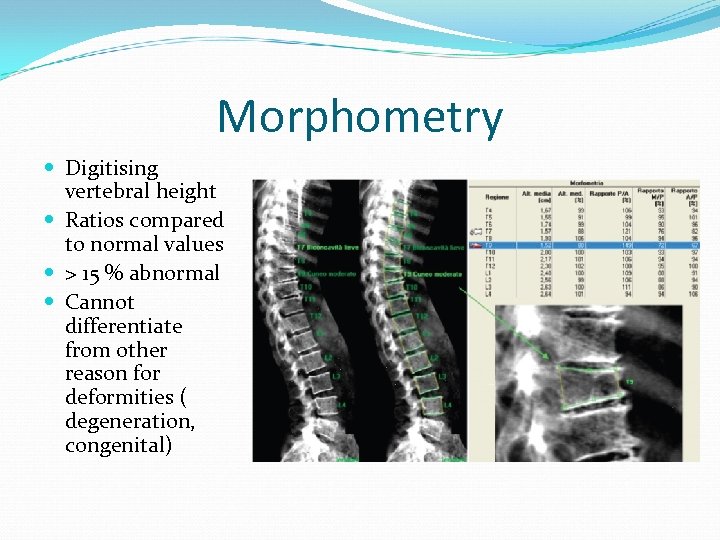 Morphometry Digitising vertebral height Ratios compared to normal values > 15 % abnormal Cannot