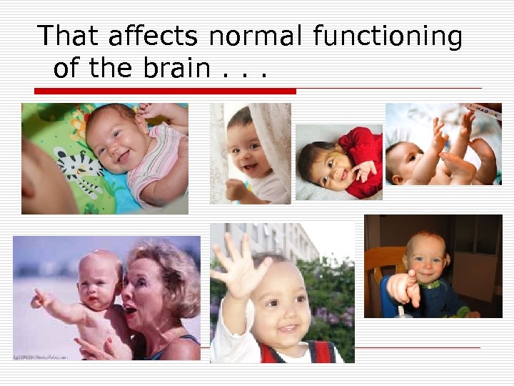 That affects normal functioning of the brain. . . 