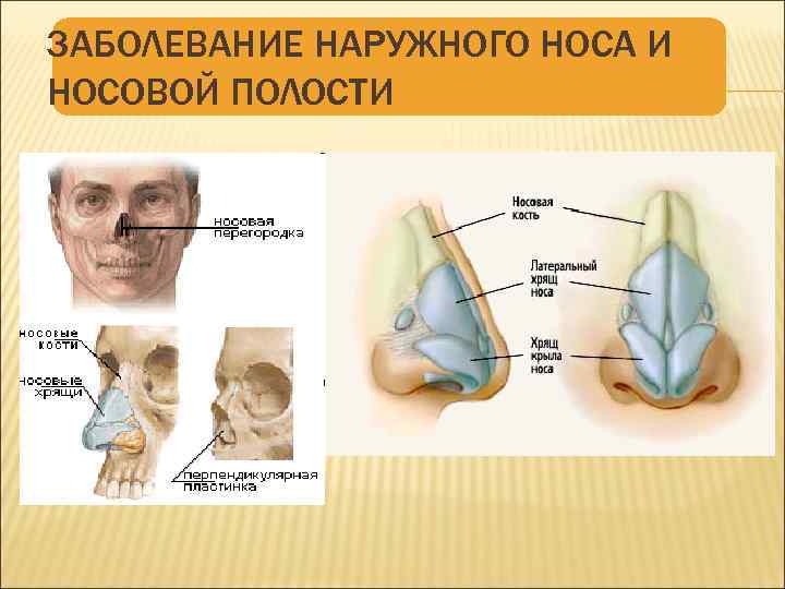 ЗАБОЛЕВАНИЕ НАРУЖНОГО НОСА И НОСОВОЙ ПОЛОСТИ 