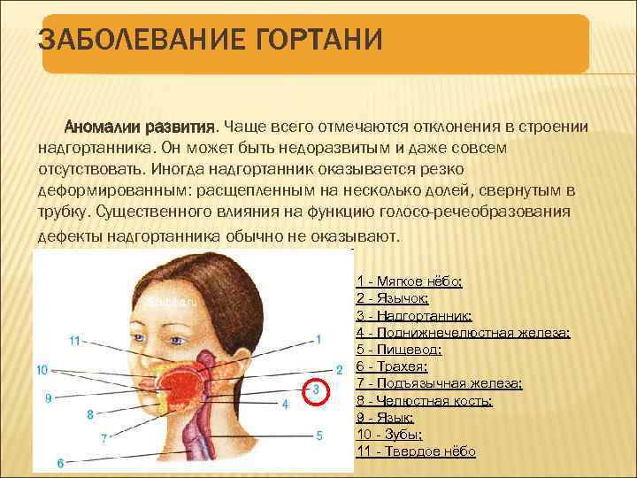 Аномалии развития гортани презентация