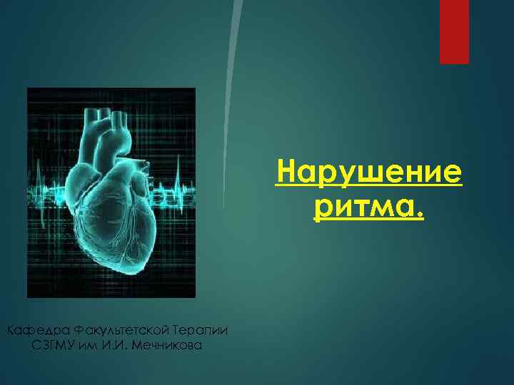 Нарушение ритма. Кафедра Факультетской Терапии СЗГМУ им И. И. Мечникова 