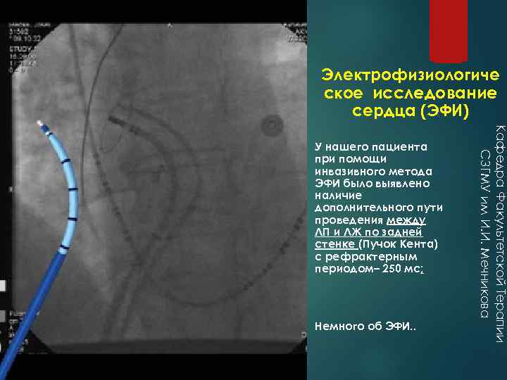 Электрофизиологиче ское исследование сердца (ЭФИ) Немного об ЭФИ. . Кафедра Факультетской Терапии СЗГМУ им