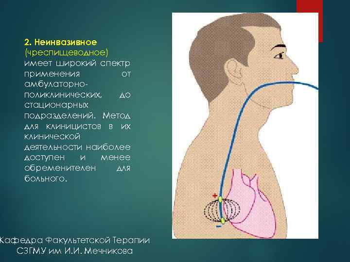 2. Неинвазивное (чреспищеводное) имеет широкий спектр применения от амбулаторно поликлинических, до стационарных подразделений. Метод