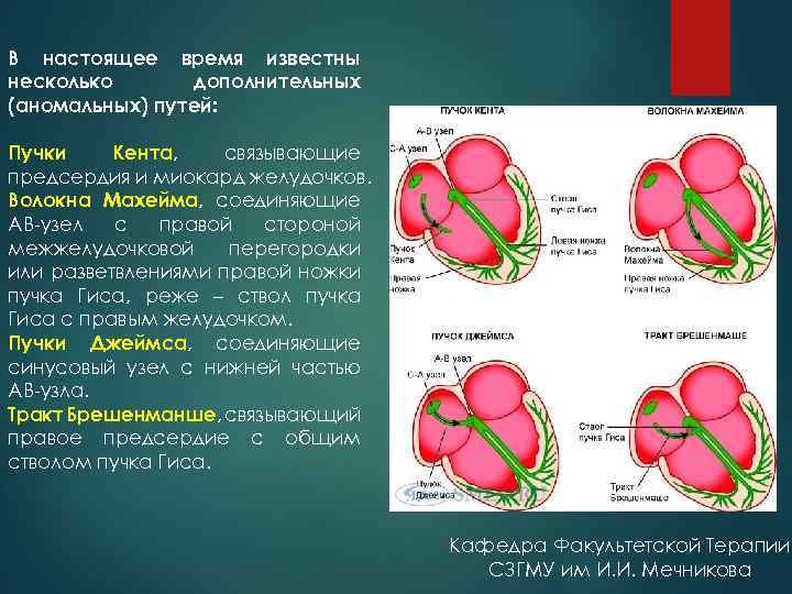 В настоящее время известны несколько дополнительных (аномальных) путей: Пучки Кента, связывающие предсердия и миокард