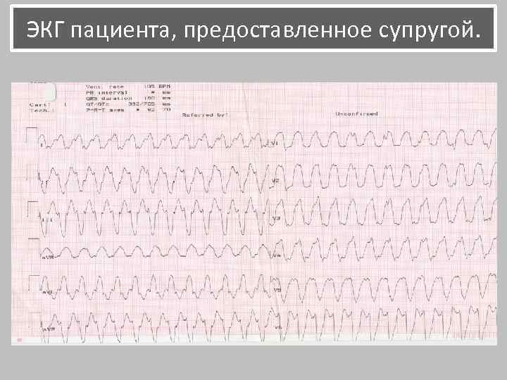 ЭКГ пациента, предоставленное супругой. 