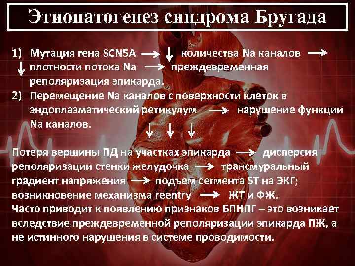 Этиопатогенез синдрома Бругада 1) Мутация гена SCN 5 A количества Na каналов плотности потока