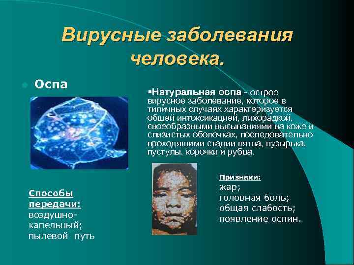 Вирусные заболевания человека. l Оспа §Натуральная оспа - острое вирусное заболевание, которое в типичных