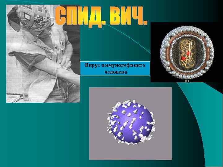 Вирус иммунодефицита человека 