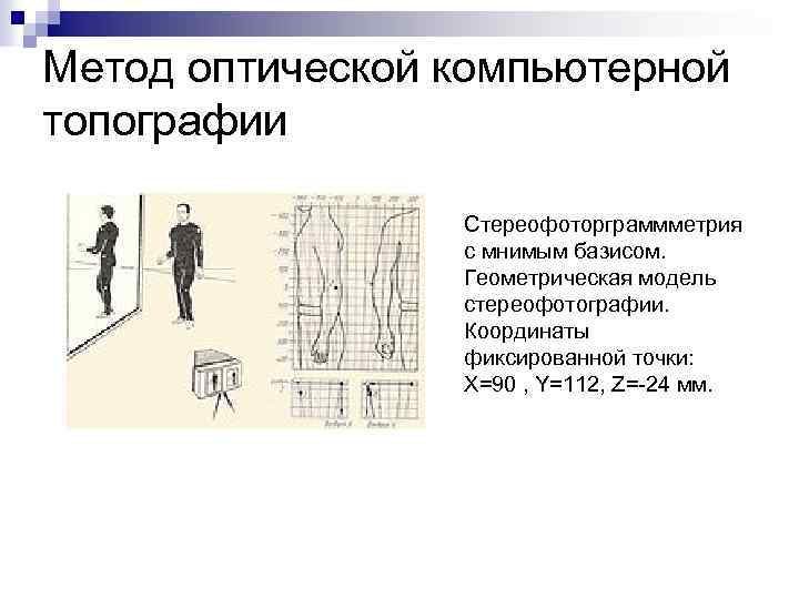 Метод оптической компьютерной топографии Стереофоторграммметрия с мнимым базисом. Геометрическая модель стереофотографии. Координаты фиксированной точки: