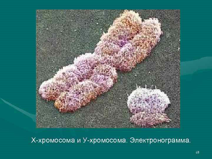 Х-хромосома и У-хромосома. Электронограмма. 68 