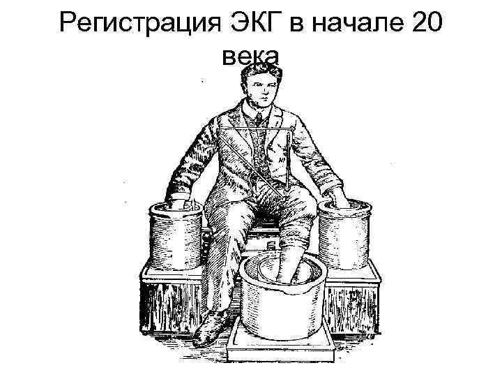 Регистрация ЭКГ в начале 20 века 