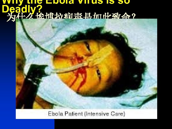 Why the Ebola Virus is so Deadly? 为什么埃博拉病毒是如此致命？ 