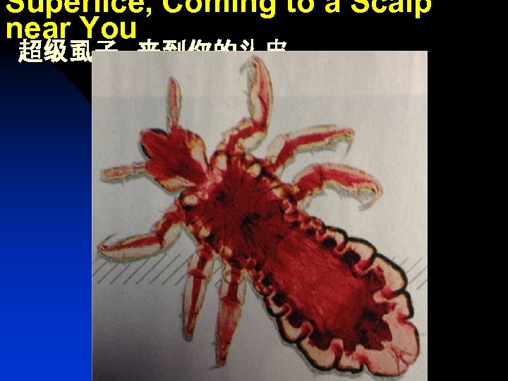 Superlice, Coming to a Scalp near You 超级虱子，来到你的头皮 