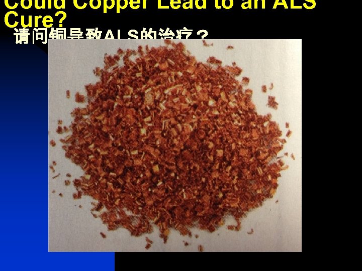 Could Copper Lead to an ALS Cure? 请问铜导致ALS的治疗？ 
