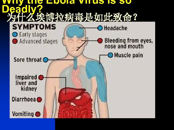 Why the Ebola Virus is so Deadly? 为什么埃博拉病毒是如此致命？ 