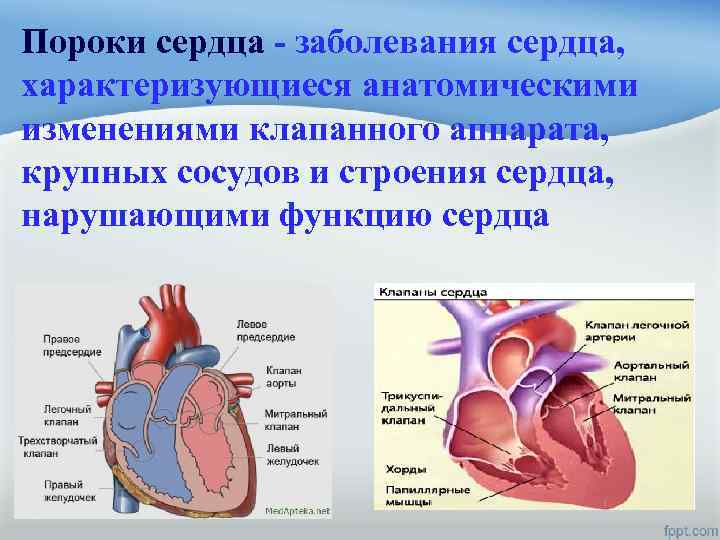 Пороки сердца - заболевания сердца, характеризующиеся анатомическими изменениями клапанного аппарата, крупных сосудов и строения