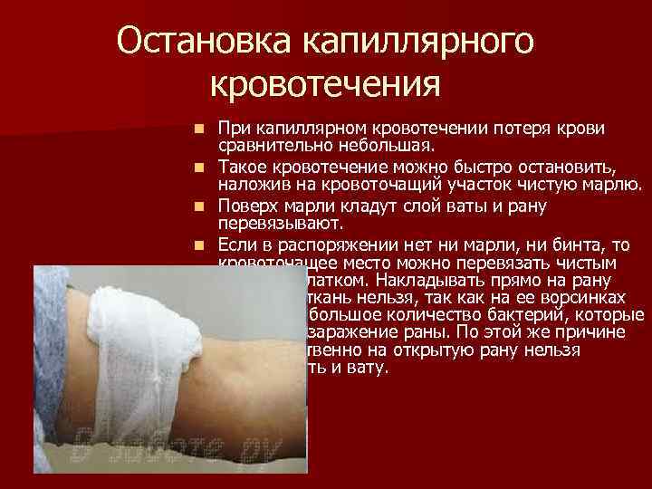 Остановка капиллярного кровотечения При капиллярном кровотечении потеря крови сравнительно небольшая. n Такое кровотечение можно