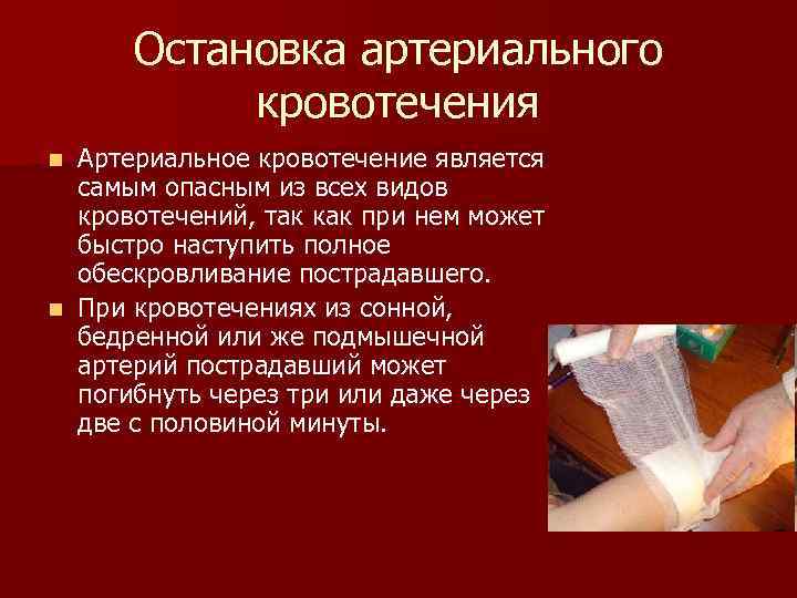 Остановка артериального кровотечения Артериальное кровотечение является самым опасным из всех видов кровотечений, так как