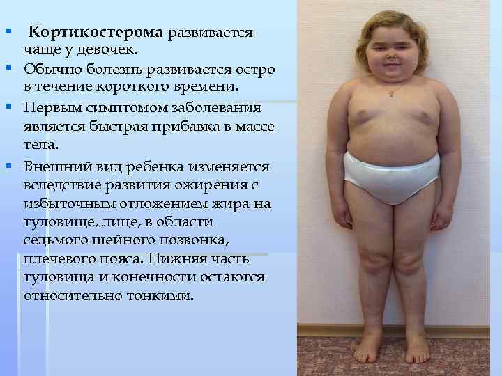 § Кортикостерома развивается чаще у девочек. § Обычно болезнь развивается остро в течение короткого