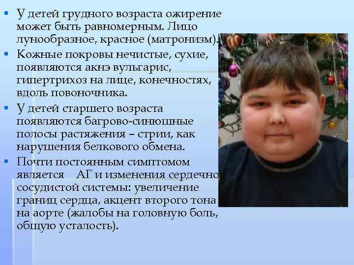 § У детей грудного возраста ожирение может быть равномерным. Лицо лунообразное, красное (матронизм). §