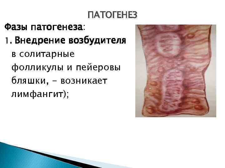 ПАТОГЕНЕЗ Фазы патогенеза: 1. Внедрение возбудителя в солитарные фолликулы и пейеровы бляшки, - возникает