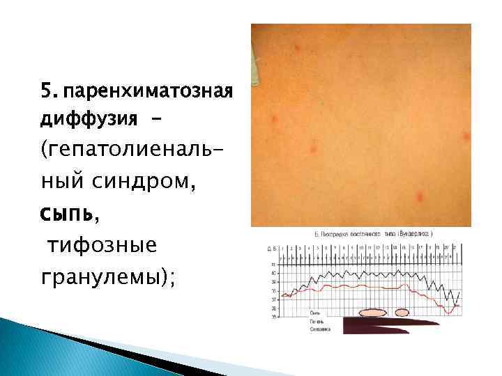 5. паренхиматозная диффузия - (гепатолиенальный синдром, сыпь, тифозные гранулемы); 