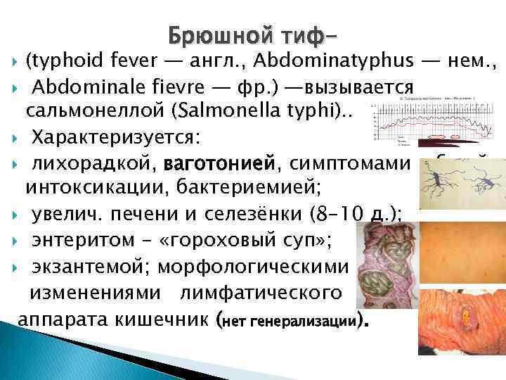 Брюшной тиф- (typhoid fever — англ. , Abdominatyphus — нем. , Аbdominale fievre —