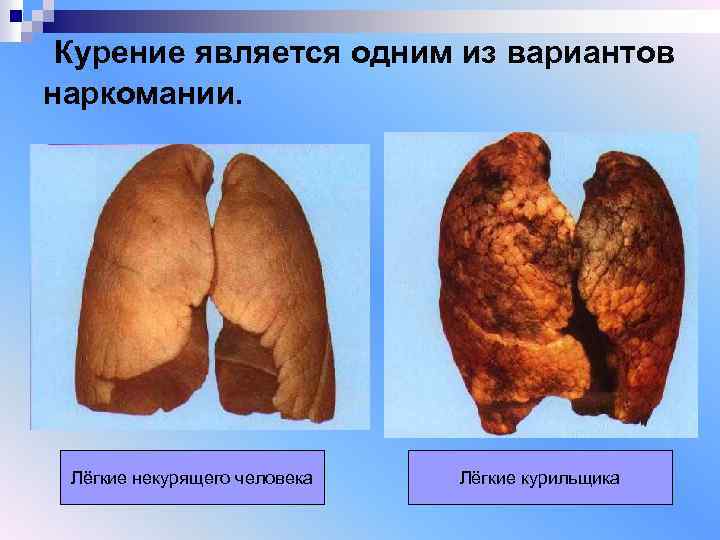  Курение является одним из вариантов наркомании. Лёгкие некурящего человека Лёгкие курильщика 