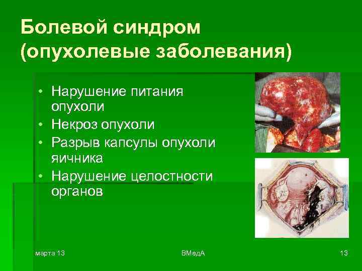 Болевой синдром (опухолевые заболевания) • Нарушение питания опухоли • Некроз опухоли • Разрыв капсулы