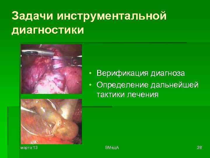 Задачи инструментальной диагностики • Верификация диагноза • Определение дальнейшей тактики лечения марта 13 ВМед.