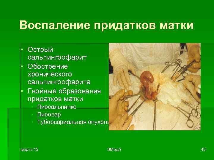 Воспаление придатков матки • Острый сальпингоофарит • Обострение хронического сальпингоофарита • Гнойные образования придатков