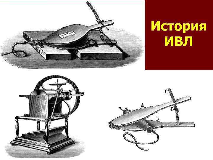 История ИВЛ Leroy d’Etiolles 1821 г. 