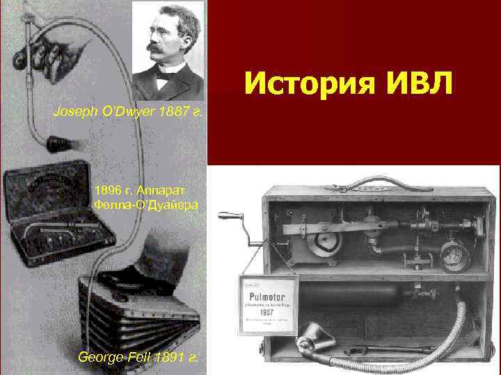 История ИВЛ Joseph O'Dwyer 1887 г. 1896 г. Аппарат Фелла-О’Дуайера George Fell 1891 г.
