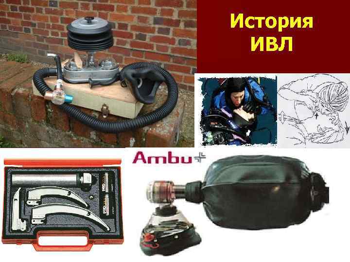 История ИВЛ с 1953 г. 