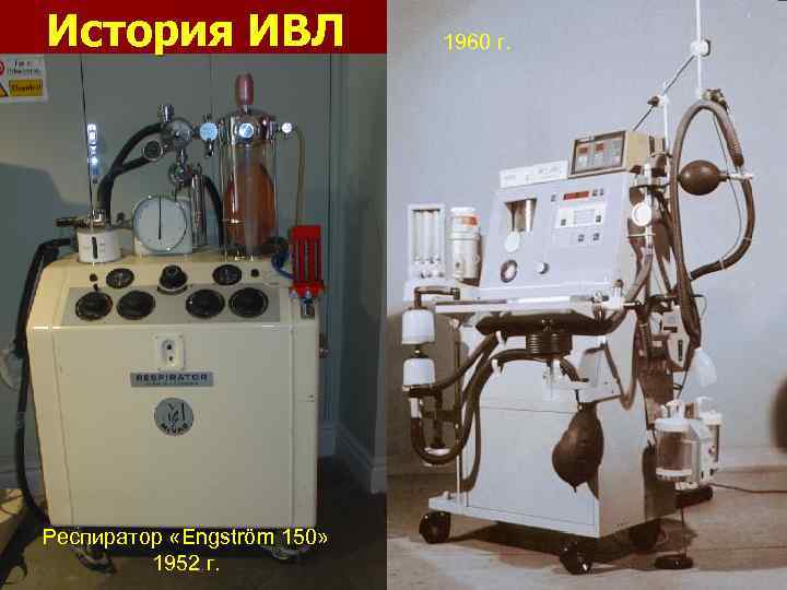 История ИВЛ Респиратор «Engström 150» 1952 г. 1960 г. 