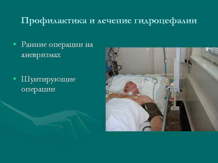 Профилактика и лечение гидроцефалии • Ранние операции на аневризмах • Шунтирующие операции 