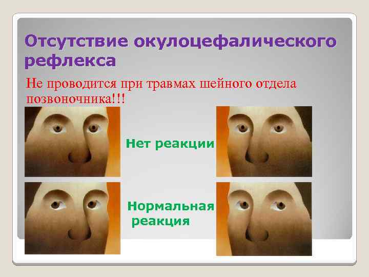 патологические рефлексы новорожденных. принципы энтерального питания. повышение рефлексов. гиперрефлексия это в неврологии. глубокие сухожильные рефлексы.