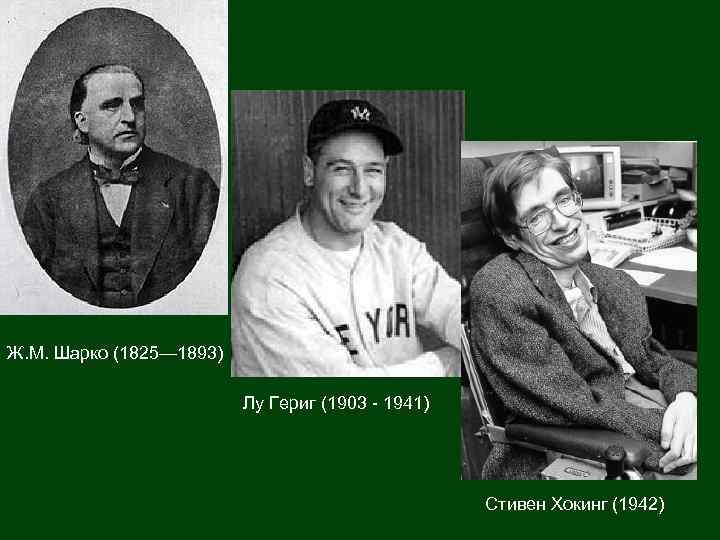 Ж. М. Шарко (1825— 1893) Лу Гериг (1903 - 1941) Стивен Хокинг (1942) 