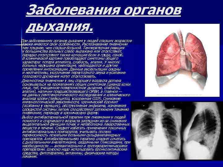 Заболевания органов дыхания. При заболеваниях органов дыхания у людей старших возрастов также имеются свои