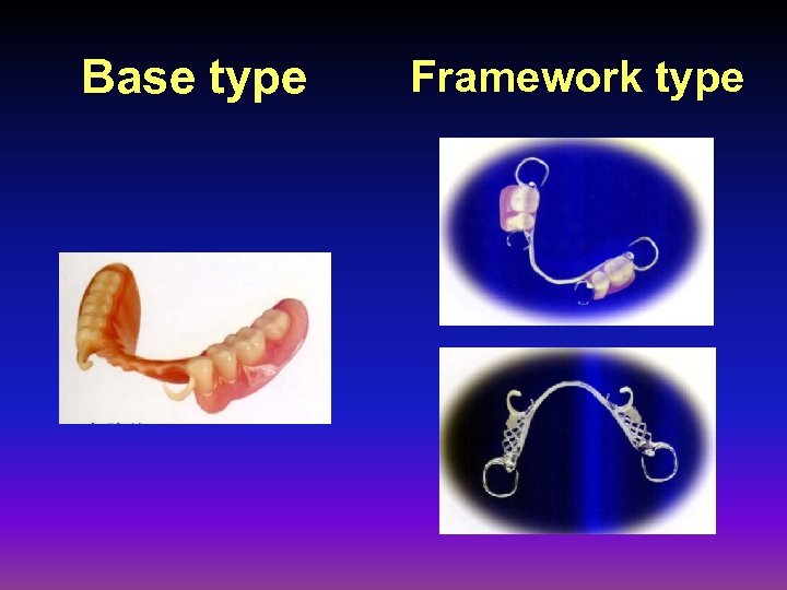 Base type Framework type 