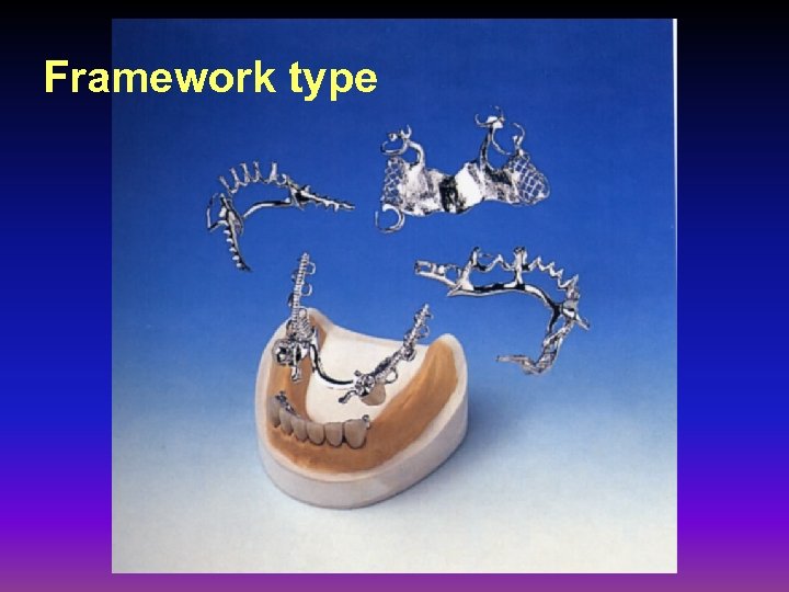 Framework type 