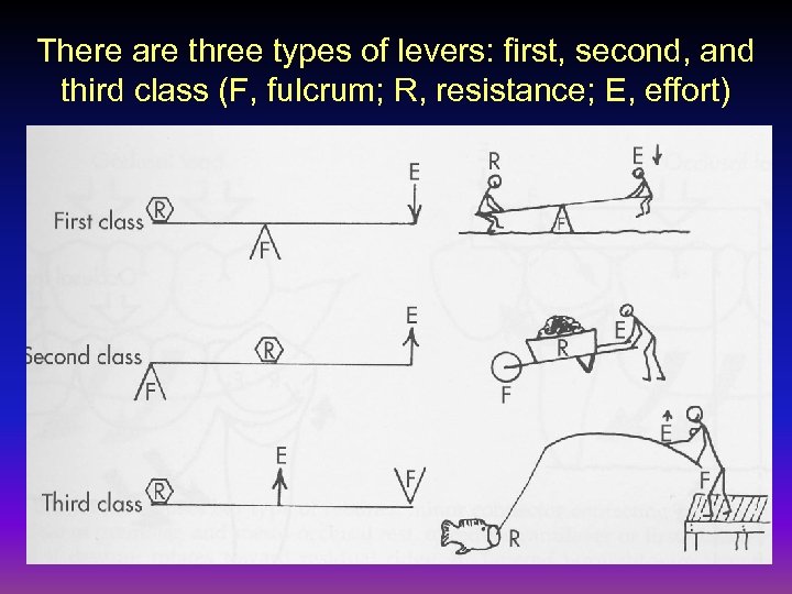 There are three types of levers: first, second, and third class (F, fulcrum; R,