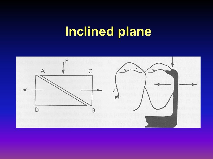 Inclined plane 