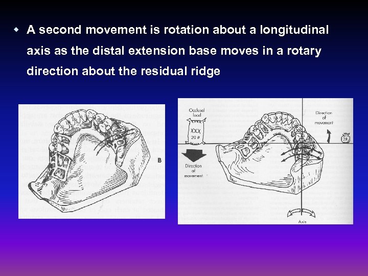 w A second movement is rotation about a longitudinal axis as the distal extension