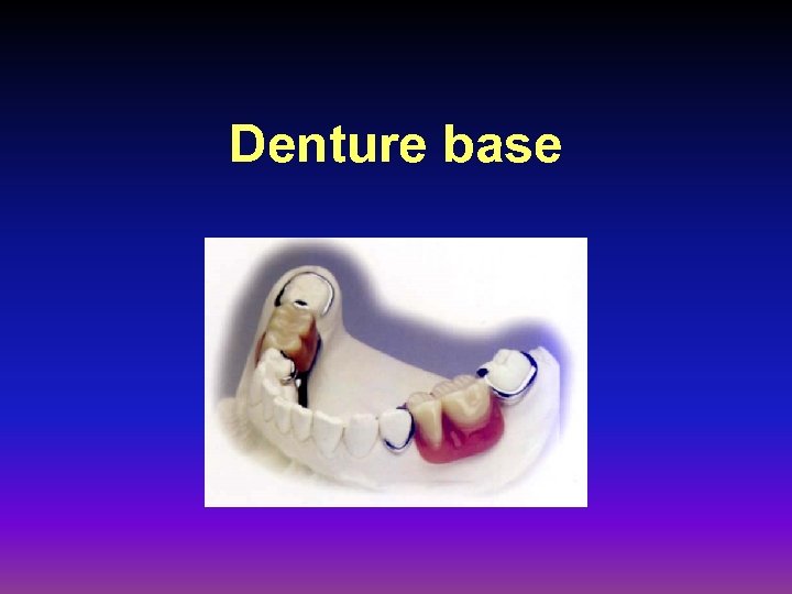 Denture base 