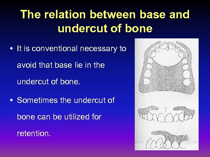 The relation between base and undercut of bone w It is conventional necessary to