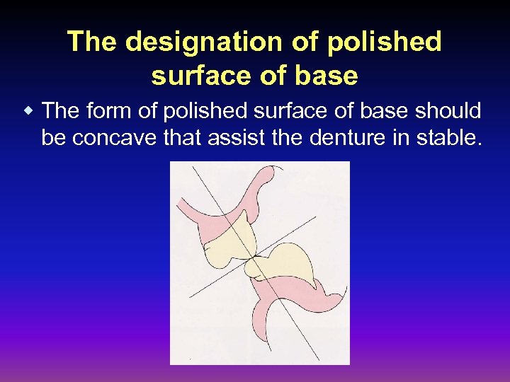 The designation of polished surface of base w The form of polished surface of