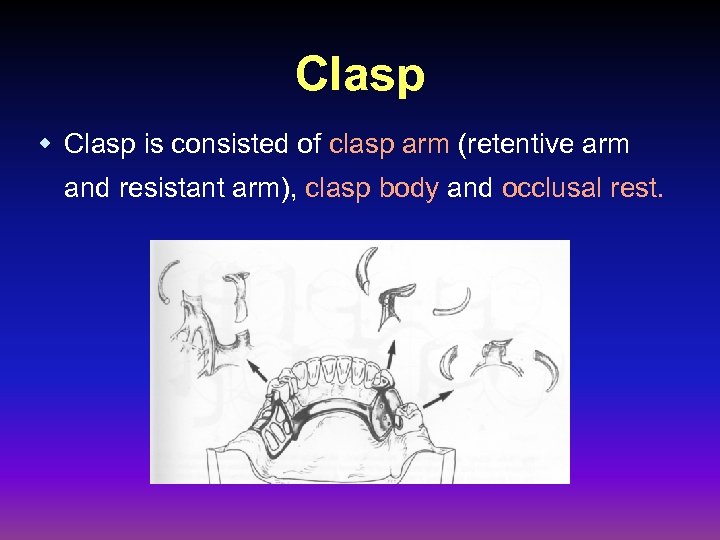 Clasp w Clasp is consisted of clasp arm (retentive arm and resistant arm), clasp